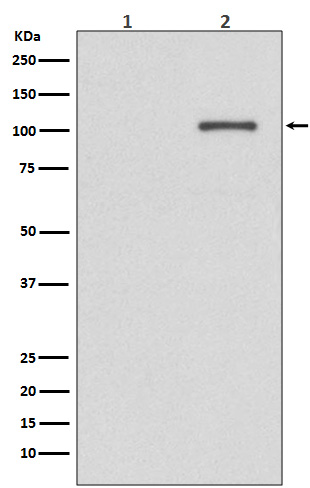 Phospho-IRE1 (Ser724)