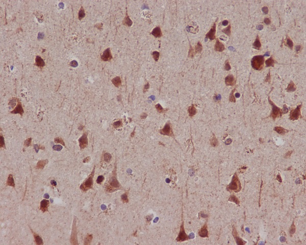 Rabbit Monoclonal Antibody to Phospho-MSK1 (Ser376) 