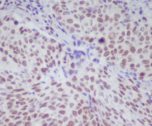 Rabbit Monoclonal Antibody to Phospho-STAT1 (Ser727) 