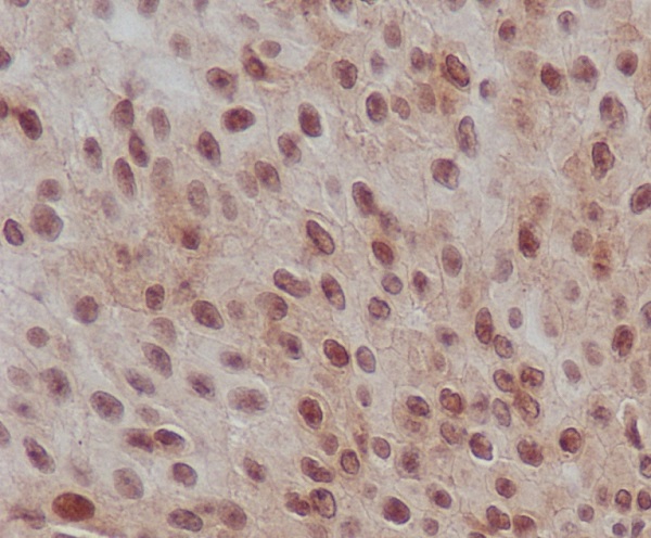 Rabbit Monoclonal Antibody to Phospho-Smad2 (Ser255) 