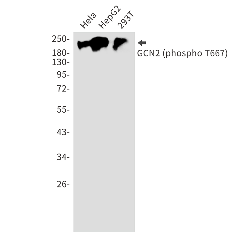 Phospho-GCN2 (Thr667)