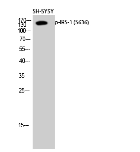 Phospho-IRS1 (Ser636)