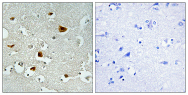 Rabbit Polyclonal Antibody to Phospho-IRS1 (Ser636)