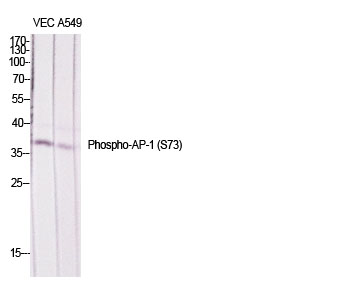 Phospho-JunD (Ser73/100)