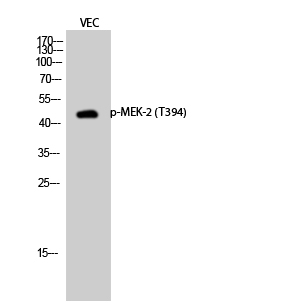 Rabbit Polyclonal Antibody to Phospho-MEK2 (Thr394)