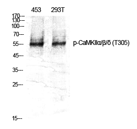 Phospho-CaMKII (Thr305)