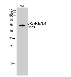 Rabbit Polyclonal Antibody to Phospho-CaMKII (Thr305)