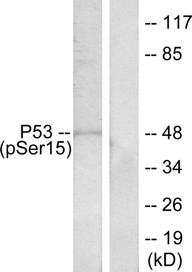 Phospho-p53 (Ser15)