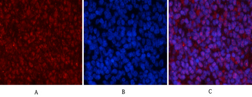 Rabbit Polyclonal Antibody to Phospho-p53 (Ser15)