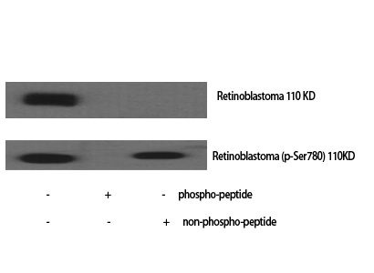 Phospho-Rb (Ser780)