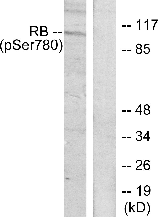 Rabbit Polyclonal Antibody to Phospho-Rb (Ser780)