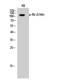 Rabbit Polyclonal Antibody to Phospho-Rb (Ser780)