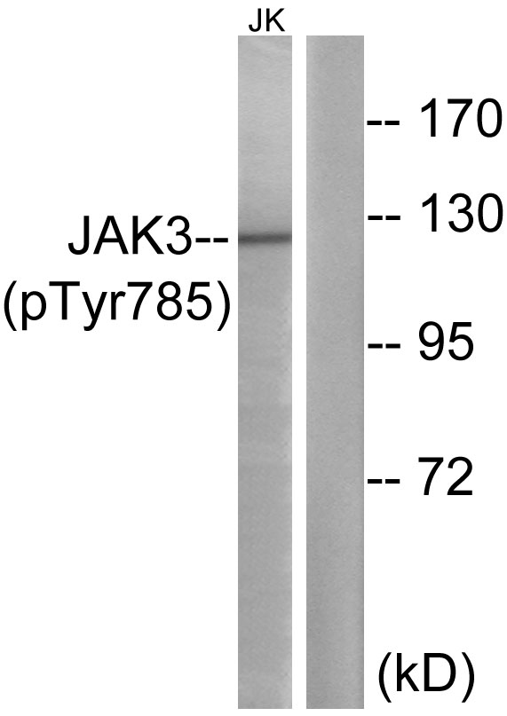 Rabbit Polyclonal Antibody to Phospho-JAK3 (Tyr785)