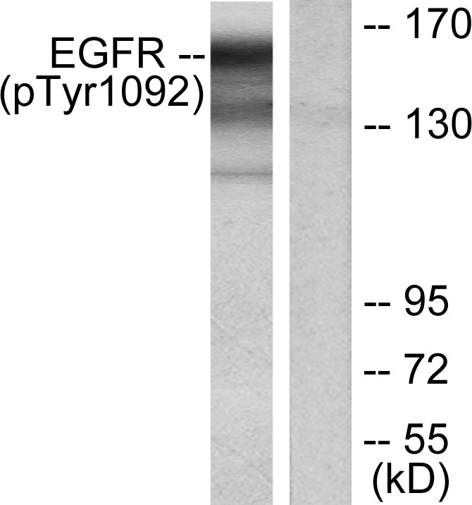 Rabbit Polyclonal Antibody to Phospho-EGFR (Tyr1092)