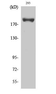 Phospho-IRS1 (Ser639)