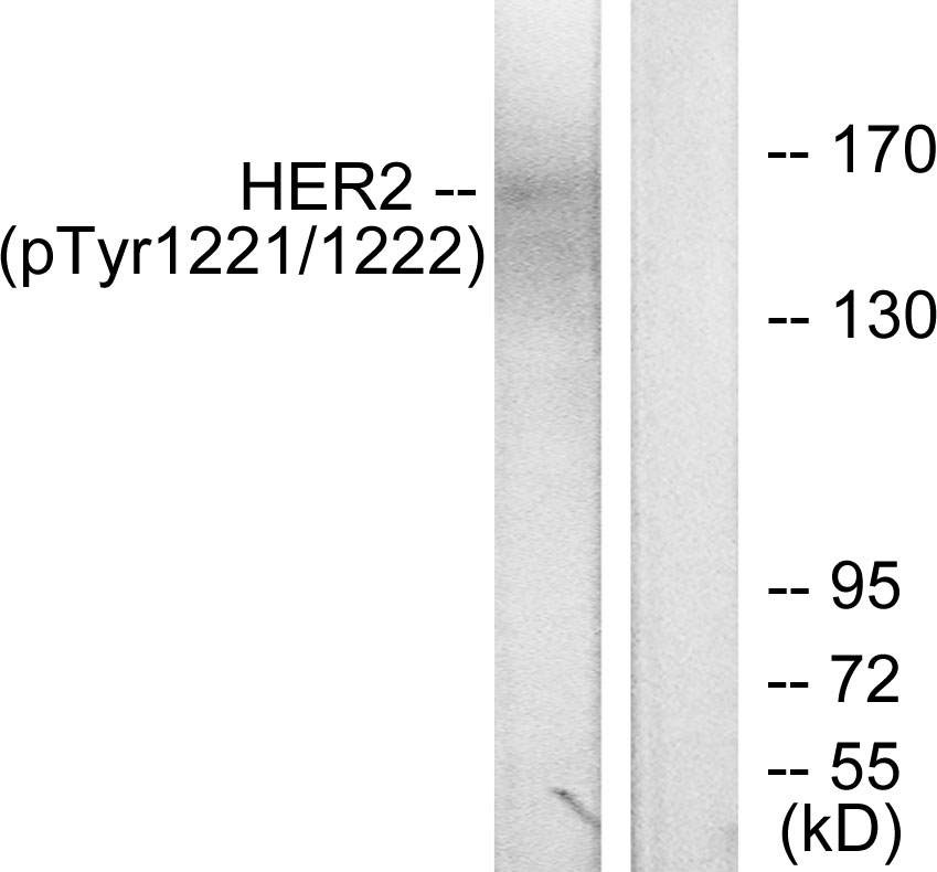 Rabbit Polyclonal Antibody to Phospho-ErbB 2 (Tyr1221/Tyr1222)