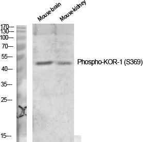 Phospho-kappa Opioid Receptor (Ser369)