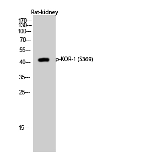Rabbit Polyclonal Antibody to Phospho-kappa Opioid Receptor (Ser369)