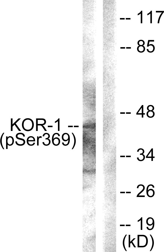 Rabbit Polyclonal Antibody to Phospho-kappa Opioid Receptor (Ser369)