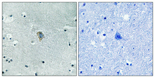 Rabbit Polyclonal Antibody to Phospho-kappa Opioid Receptor (Ser369)