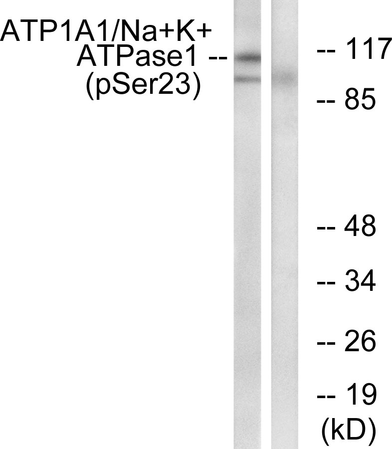 Rabbit Polyclonal Antibody to Phospho-alpha 1 Sodium Potassium ATPase (Ser23)