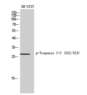 Phospho-Cardiac Troponin I (Ser22/Ser23)