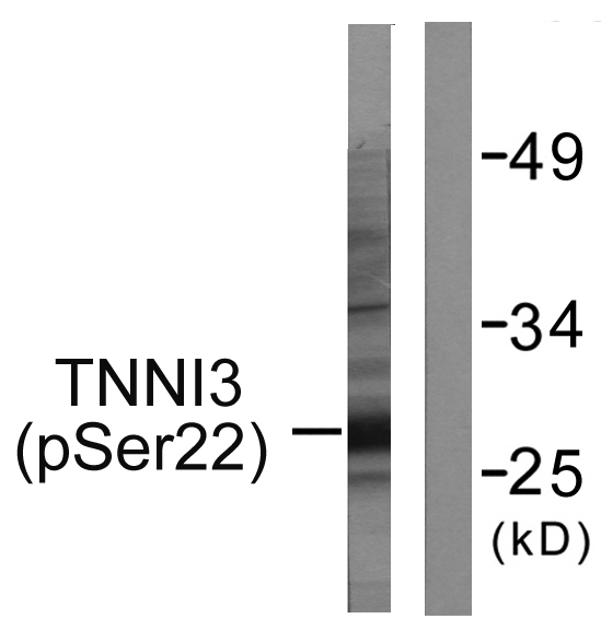 Rabbit Polyclonal Antibody to Phospho-Cardiac Troponin I (Ser22/Ser23)