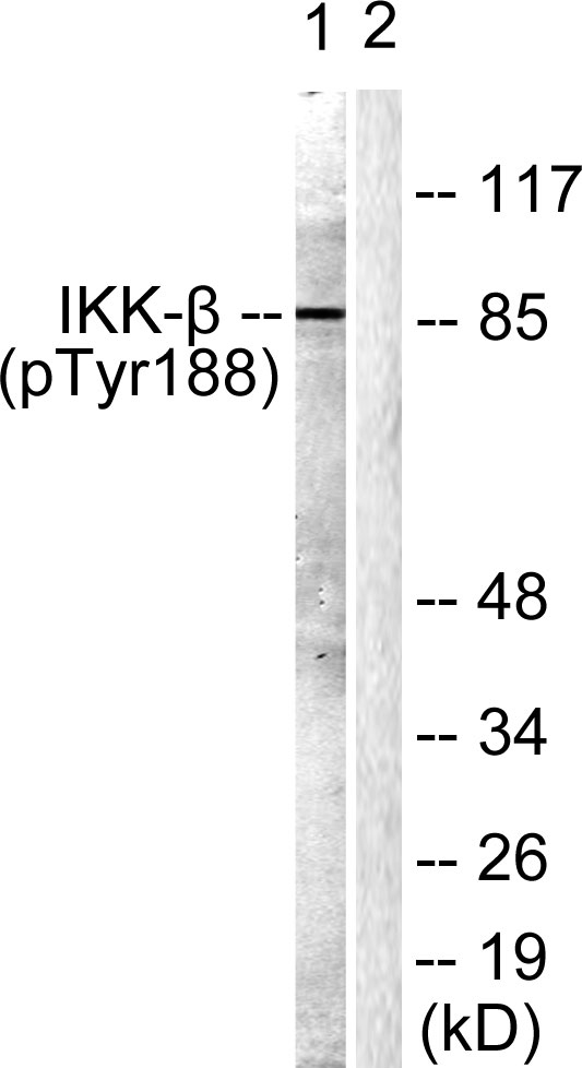 Phospho-IKK beta (Tyr188)