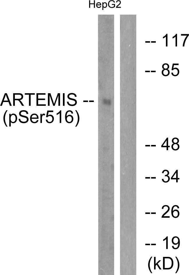 Phospho-Artemis (Ser516)