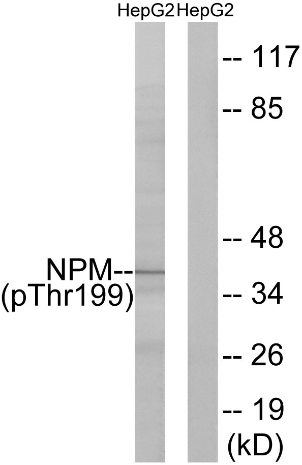 Phospho-B23 (Thr199)