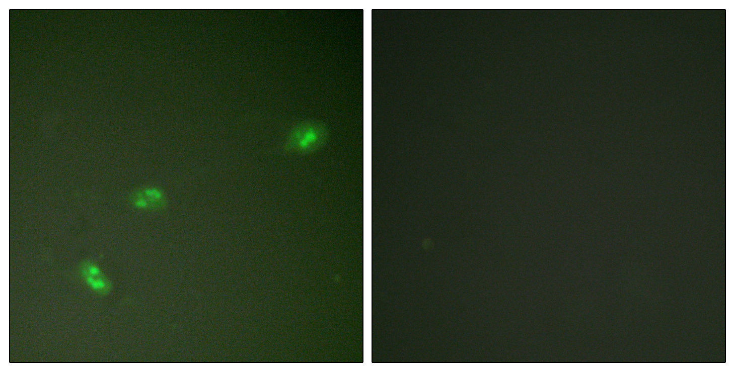 Rabbit Polyclonal Antibody to Phospho-B23 (Thr199)