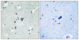Phospho-NMDAR2A/2B (Tyr1246/Tyr1252)