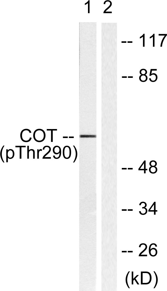Phospho-COT (Thr290)