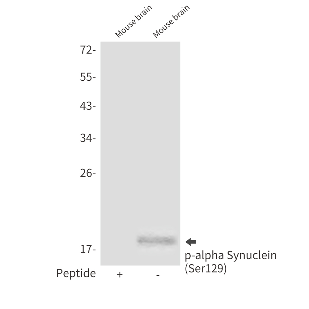 Phospho-alpha Synuclein (Ser129)