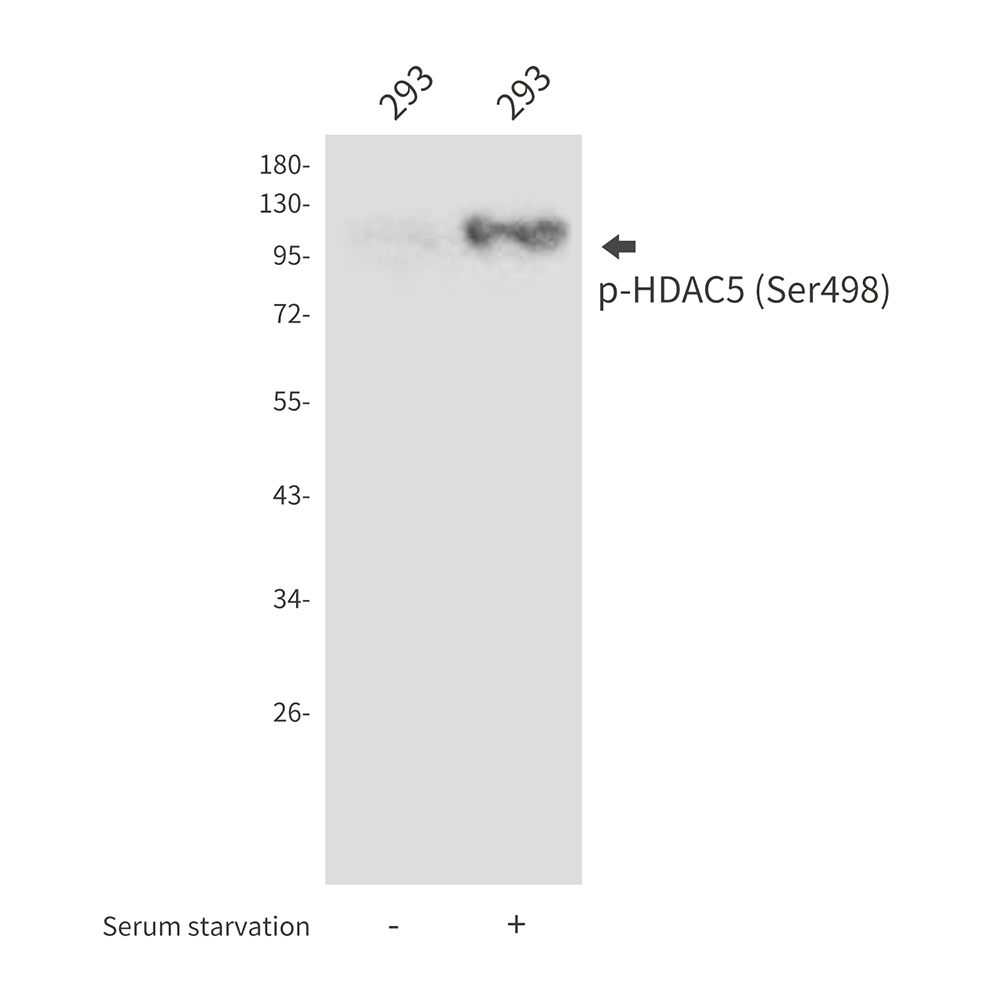 Phospho-HDAC5 (Ser498)