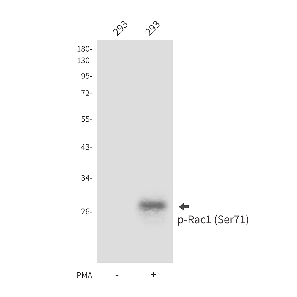 Phospho-Rac1 (Ser71)