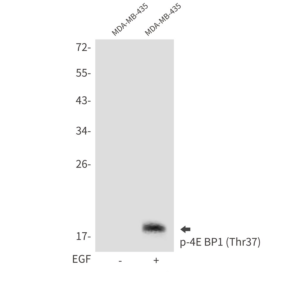 Phospho-4E BP1 (Thr37)