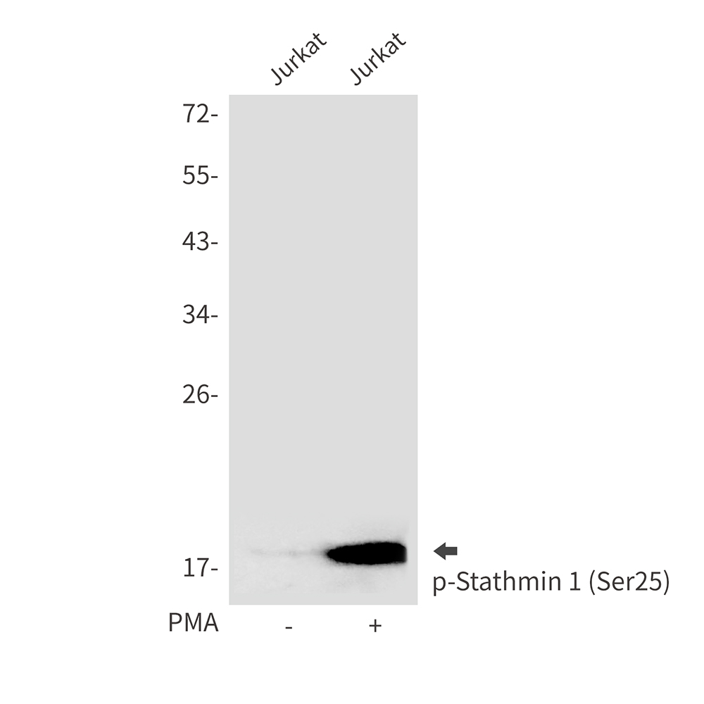 Phospho-Stathmin 1 (Ser25)