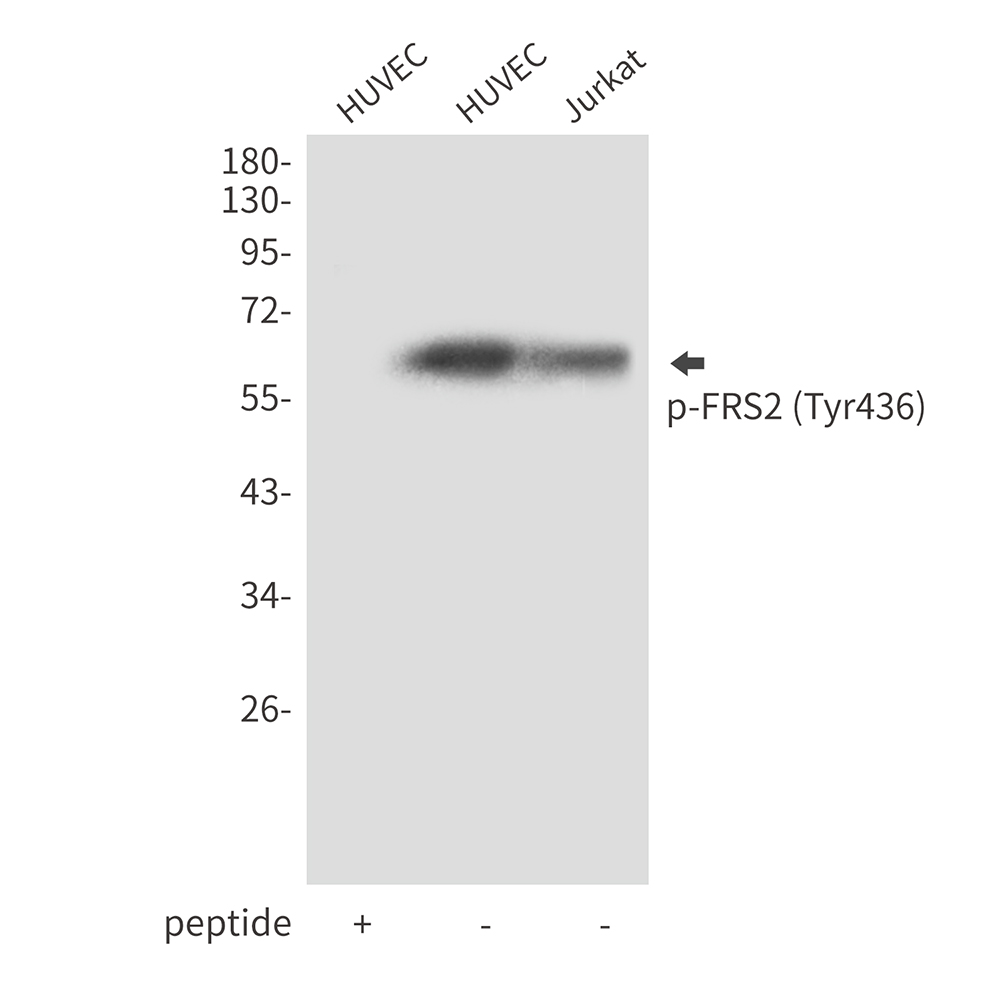 Phospho-FRS2 (Tyr436)