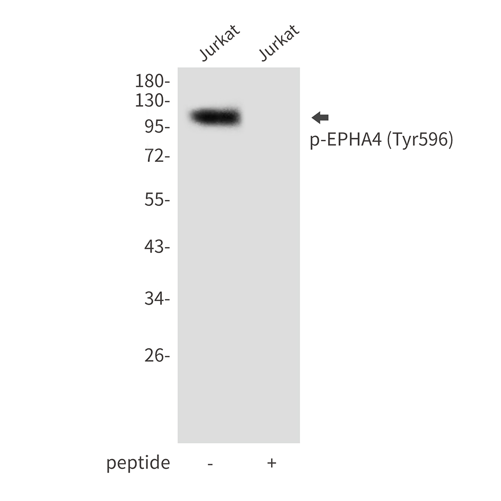 Phospho-EPHA4 (Tyr596)