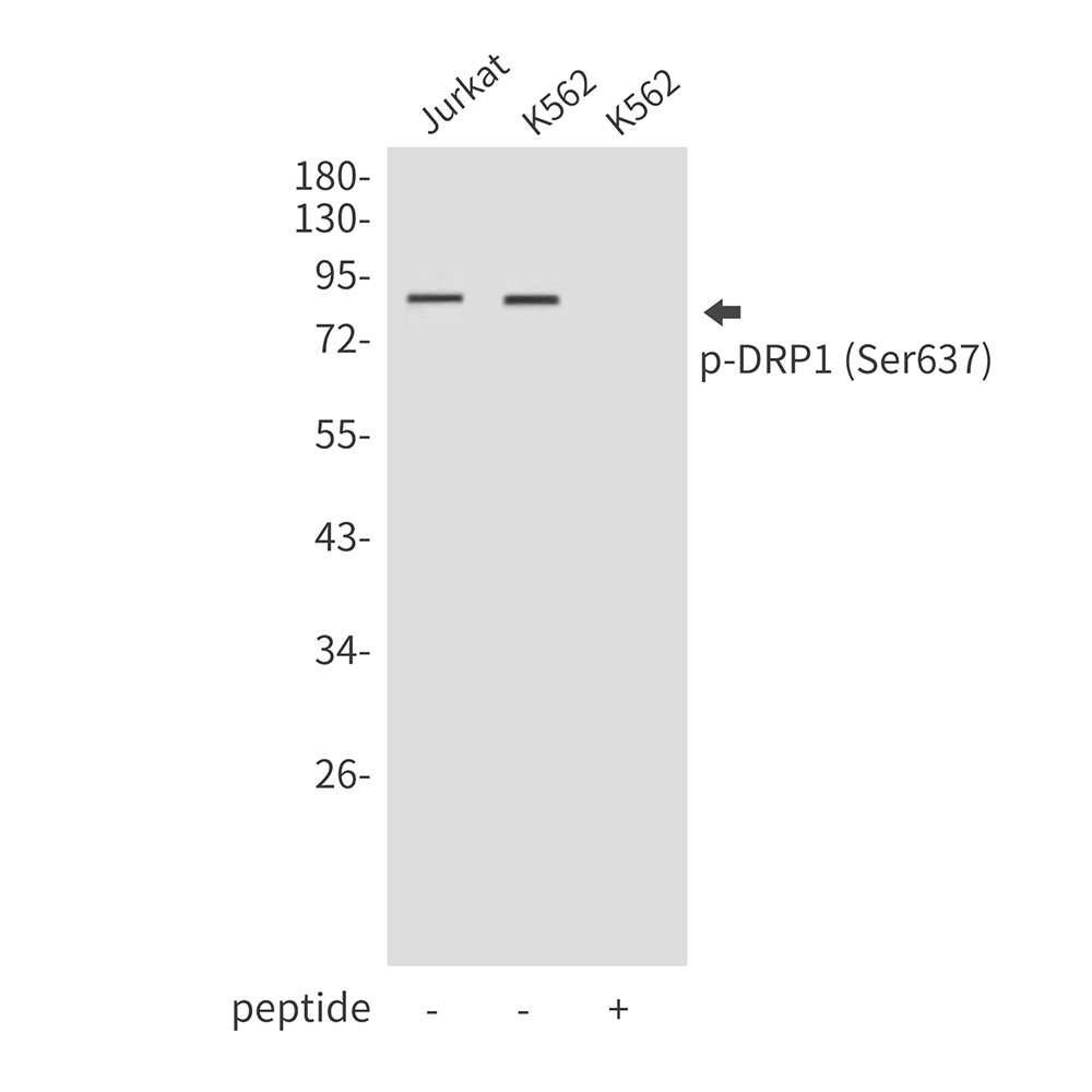 Phospho-DRP1 (Ser637)