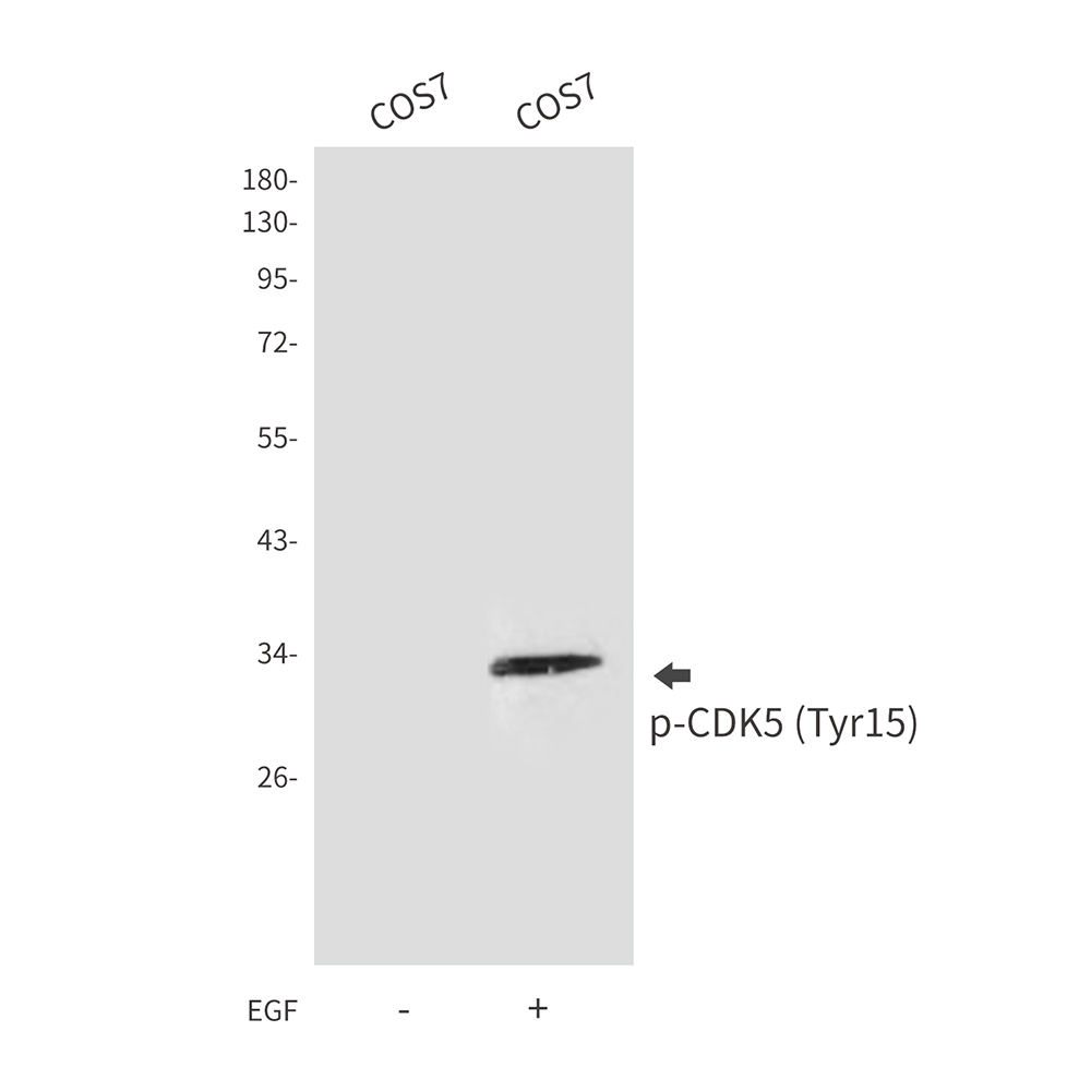 Phospho-CDK5 (Tyr15)