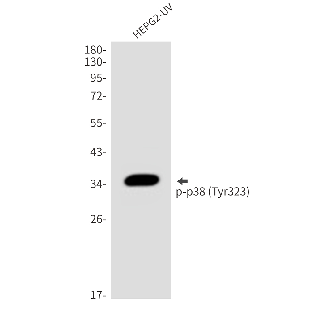 Phospho-p38 (Tyr323)