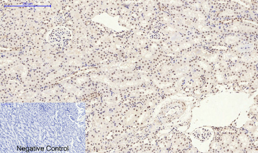 Rabbit Polyclonal Antibody to Phospho-p38 (Tyr323)