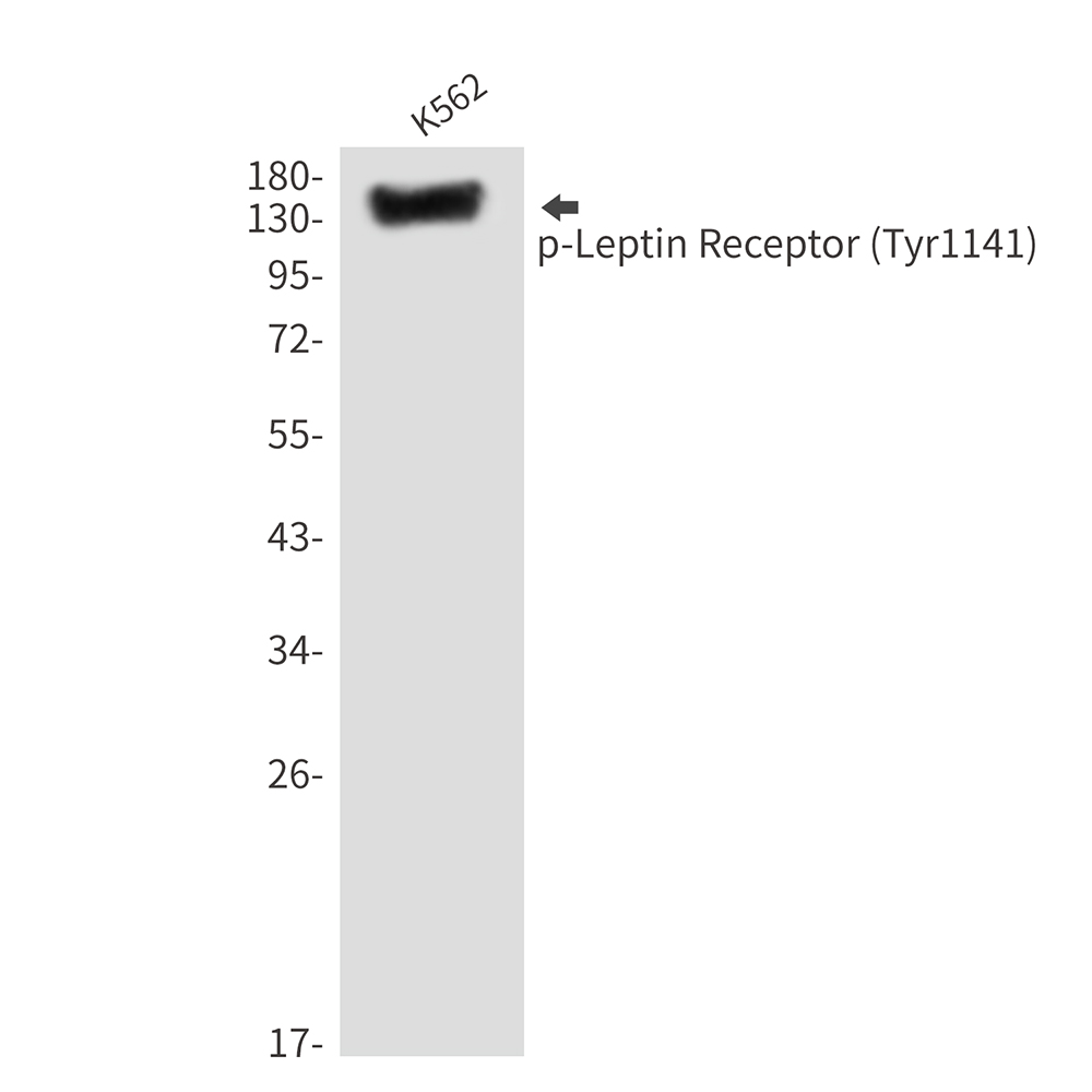 Phospho-Leptin Receptor (Tyr1141)