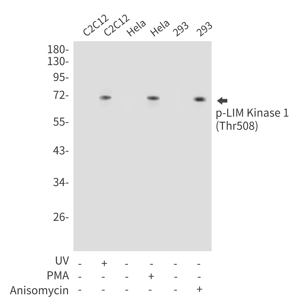 Phospho-LIM Kinase 1 (Thr508)
