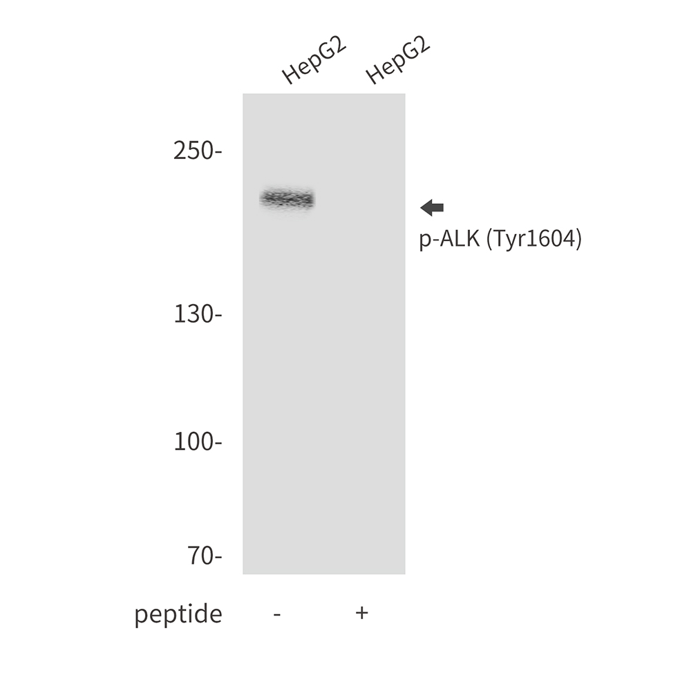 Phospho-ALK (Tyr1604)