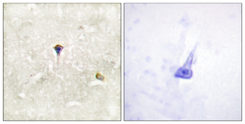 Rabbit Polyclonal Antibody to Phospho-ALK (Tyr1604)