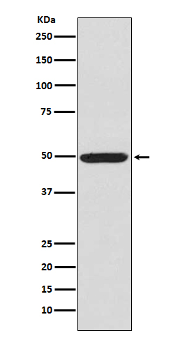 Phospho-PKA RII alpha (Ser99)