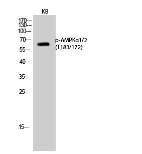 Rabbit Polyclonal Antibody to Phospho-AMPK alpha 1/2 (Thr183/Thr172)